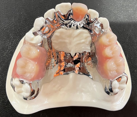 入れ歯（義歯）治療の種類・料金 - 正畠歯科医院（倉敷市）